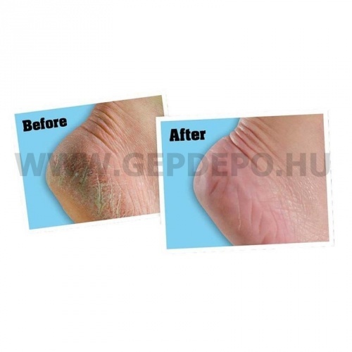 O'Keeffe's Healthy Feet lábápoló krém, tubusos 85 g
